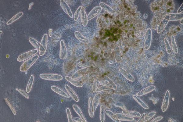 What Is a Protozoan in Microbiology? - Reproduction of protozoa