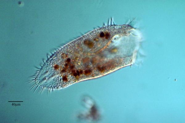 What Is a Protozoan in Microbiology?