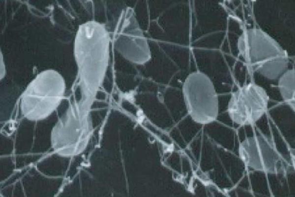 What Is Chemosynthesis and How Is It Different From Photosynthesis? - Examples of chemosynthetic organisms